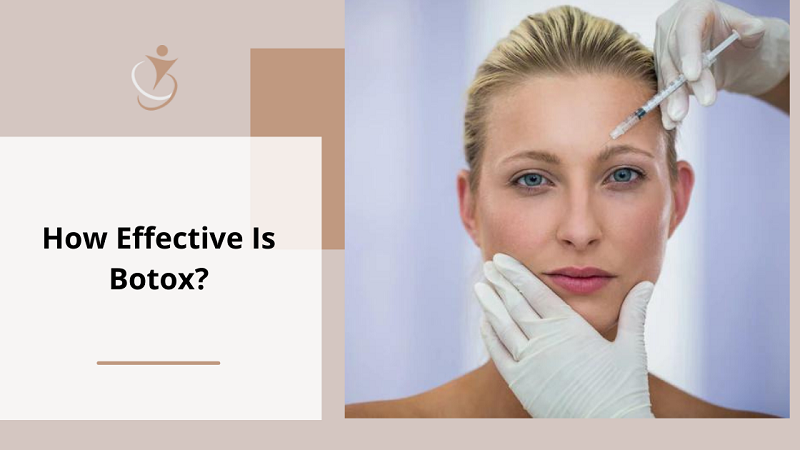 How Effective Is Botox?